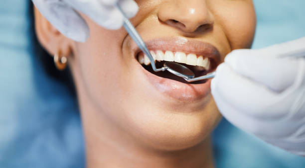 Best Emergency Tooth Extraction in Savannah, TX