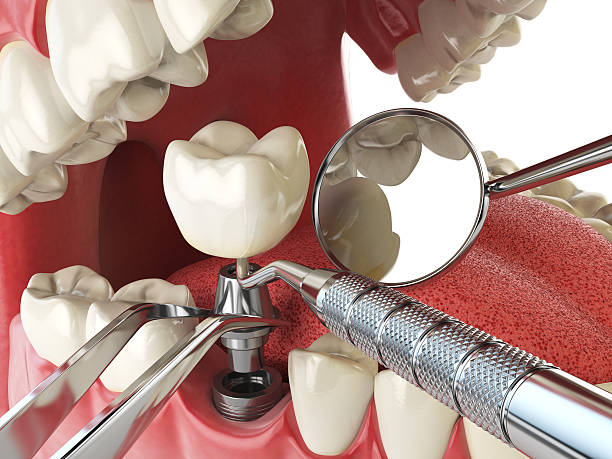 Best Cosmetic Emergency Dentistry in Savannah, TX